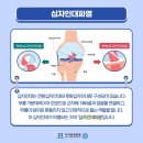 운동 중 부상 위험 높은 십자인대, 운양동정형외과에서 이미지