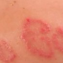 미클린의원 이미지