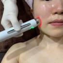 천안 쌍용동 피부관리 | 일렉트로닉 mts 관리받은 솔직 후기 “알로스킨케어”