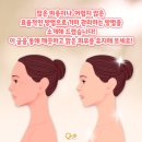 큐티스의원 네이버블로그