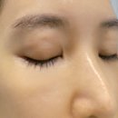 예약국 | 약국 EGF 재생크림 새살돋는 이유와 후기 (사진)