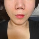 [광주 봉선동피부샵] 예민피부관리전문 피부샵 봉선동 &#39;위드비비드&#39;