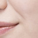 팔자주름 잡는 ‘자가진피재생술’, 1회로도 충분할까? 이미지