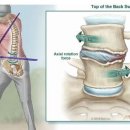 골프 선수들의 요통의 원인 이미지