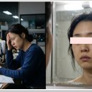 만성 스트레스가 피부에 미치는 영향 이미지