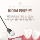 서울 훈 치과의원 이미지