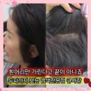 큐헤어카페 | 시흥 정왕동 염색전문 큐사랑 셀프염색 후 심각했던 엄마 두피진단 뿌리염색+클리닉 후기