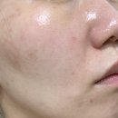 뷰티라벳 | 프로폴리스 크림 사용후기 (메디준 프로폴리스 아쿠아 크림)