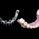 아치치과기공소 이미지