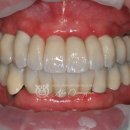 솔라움치과기공소 이미지