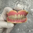 센스치과기공소 네이버블로그