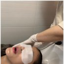 송파탈모, 탑스칼프 송파점에서 효과 톡톡히 본 후기!
