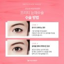 훌륭성형외과 이미지