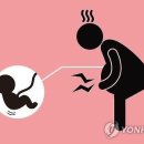 조산 이미지
