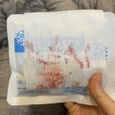 부산시립정신병원 | 부산 아이라인 문신 반영구 제거 후기 (병원 vs 샵 ㅣ 통증 ㅣ 붓기 ㅣ 비용 등 사진 많음 주의)