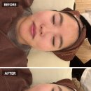 에끌로에스테틱