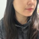 청담 울쎄라 효과시기 300샷 가격 공유