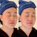 행복오일뱅크 | 복직 전 긴급 피부관리 🚨 나주피부샵 알테온 리프팅 후기