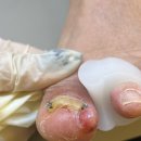 타임네일 페디베네 이미지