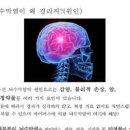 뇌수막염 증상 세균성 예방 이미지