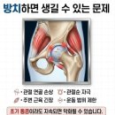 하이킥스포츠 | 다율동 바디윤필라테스, 고관절 충돌 증후군 원인 및 관리 방법