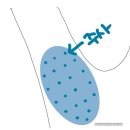 세란의원 | 세란통마취통증의학과의원 겨드랑이 다한증 보톡스 후기 (실비보험 청구 후기)