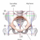 골반의 변형(분석방법) 이미지