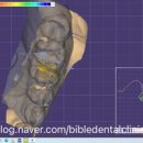 부여치과기공소 이미지