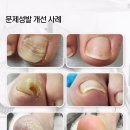 오벨리네일푸스 ❌️ (사)한국미용교육협회함께 문제성발관리 시장의 판을 바꾸다‼️ 이미지