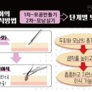 유리헤어라인
