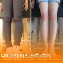 다리교정 후 키 커진 이유 화서역PT / 파장동주짓수