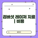 유전사우나 | 검버섯 레이저 치료 | 비용, 효과 및 후기