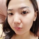 예뻐지는날더테라피