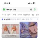 맥도널드 | 20w2d 맥도널드 수술 후기