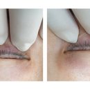 브라운아이의원 이미지