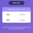 예일안과의원 티스토리