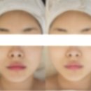 [옥정]힐링 원예 1차 | 옥정 V라인 맛집! 옥정 피부&amp;헤드스파/피부+헤드스파 통합 관리로 인생 얼굴선 갱신[이벤트 진행 중]