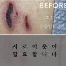 동림한의원 네이버블로그
