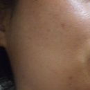 스킨케어 린 이미지