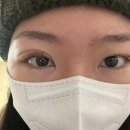 평촌서울안과의원 이미지