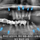 연세한치과의원 이미지