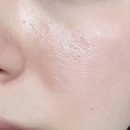 팔자주름 없애기 홈케어 루틴! 장나라 eoa 풀써마 얼굴마사지기 한 달 후기