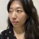 (주)비오지노키 제2공장 | 옆볼꺼짐 시술 쥬베룩볼륨 3회차 전후 후기 ｜ 논현피부과