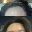 해진헤어라인