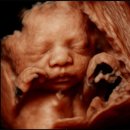 연세맘스그린여성의원 이미지