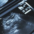 엠여성의원 이미지