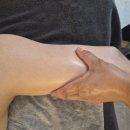 스마일 피부/미용/체형 교정 클리닉 | 목포 에스테틱 추천, 손으로만 관리하는 에끌라에스테틱 힐링아로마마사지
