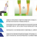 하지정맥류 초기 하지정맥류 운동 통증 이미지