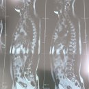 미주마취통증의학과의원 티스토리