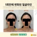 분당구청입구.수내교 | 분당 판교피부관리 찾으세요? 발로하는 피부관리 솔직후기